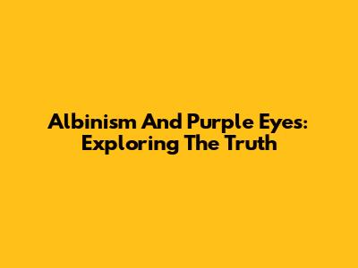 Albinism And Purple Eyes: Exploring The Truth