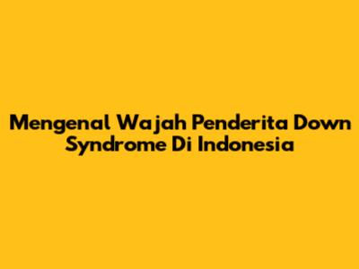 Mengenal Wajah Penderita Down Syndrome Di Indonesia