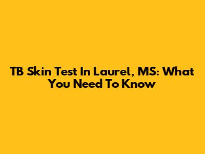 TB Skin Test In Laurel, MS: What You Need To Know